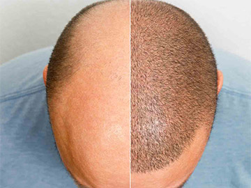 Delhi Laser Clinic