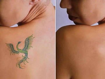 Delhi Laser Clinic